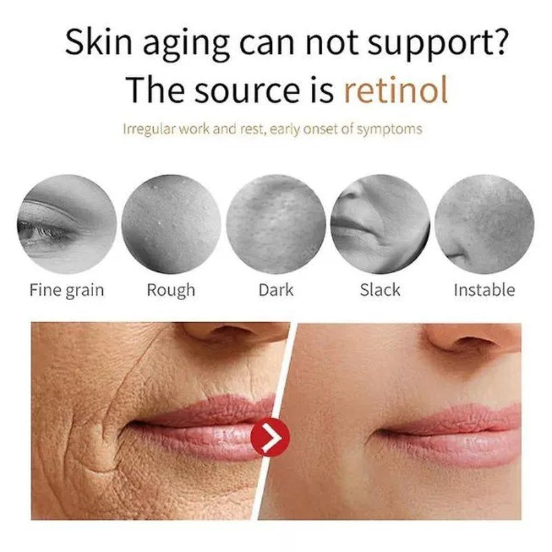 Kolagen protiv starenja sa pojačanom kolagenom za uklanjanje tamnih fleka, collagen