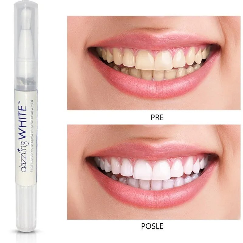 Dazzling White – Olovka za izbjeljivanje zuba – 3 za 999din.!