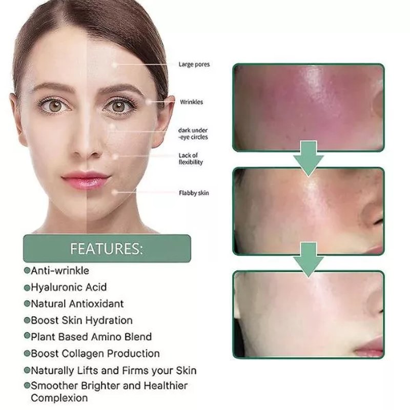 Kolagen protiv starenja sa pojačanom kolagenom za uklanjanje tamnih fleka, collagen