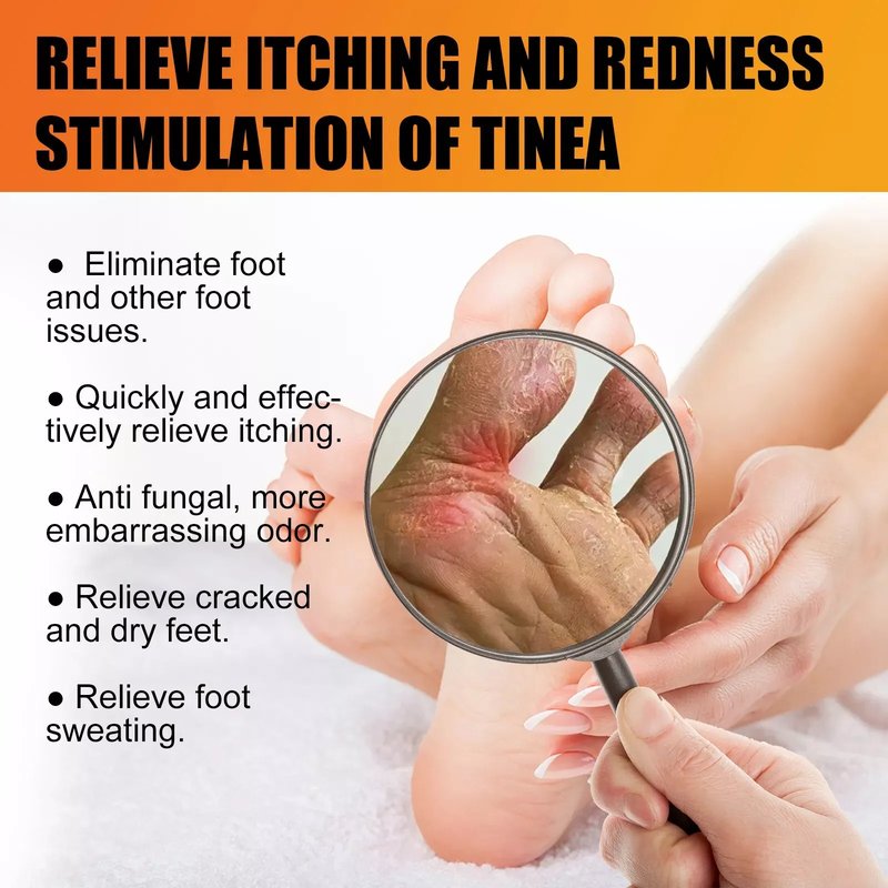 Krema protiv gljivičnih infekcija i atletsko stopalo