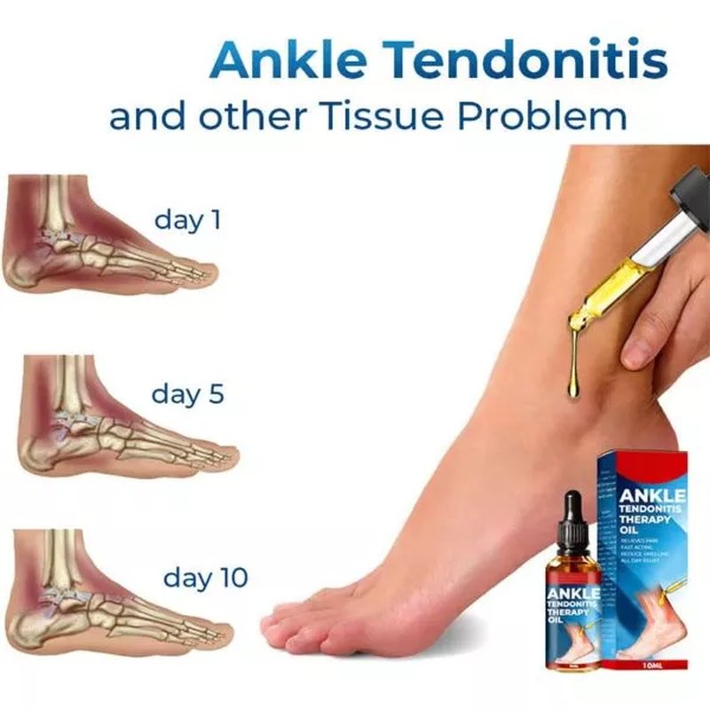 Nemačko ulje za bolne zglobove i tendonitis