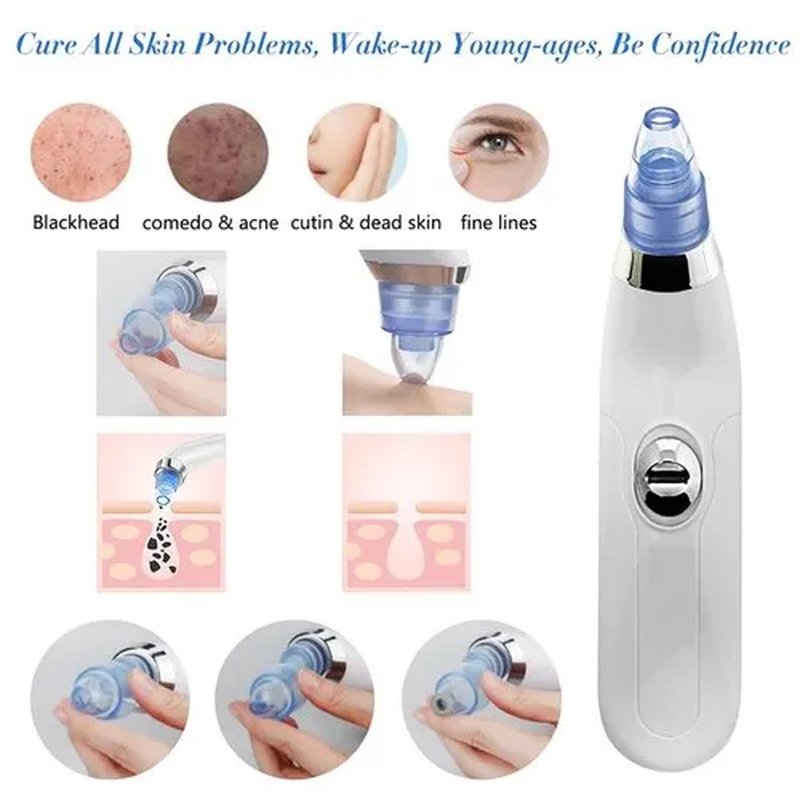 Dermasuction – Aparat za čišćenje pora i mitisera